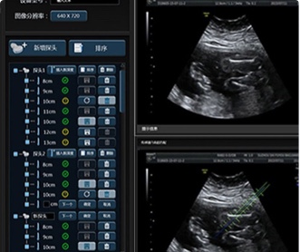 武漢睿影醫(yī)療科技超聲系統(tǒng)軟件UI設(shè)計